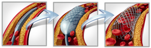 Circulation sanguine anticoagulant ph4suite.png